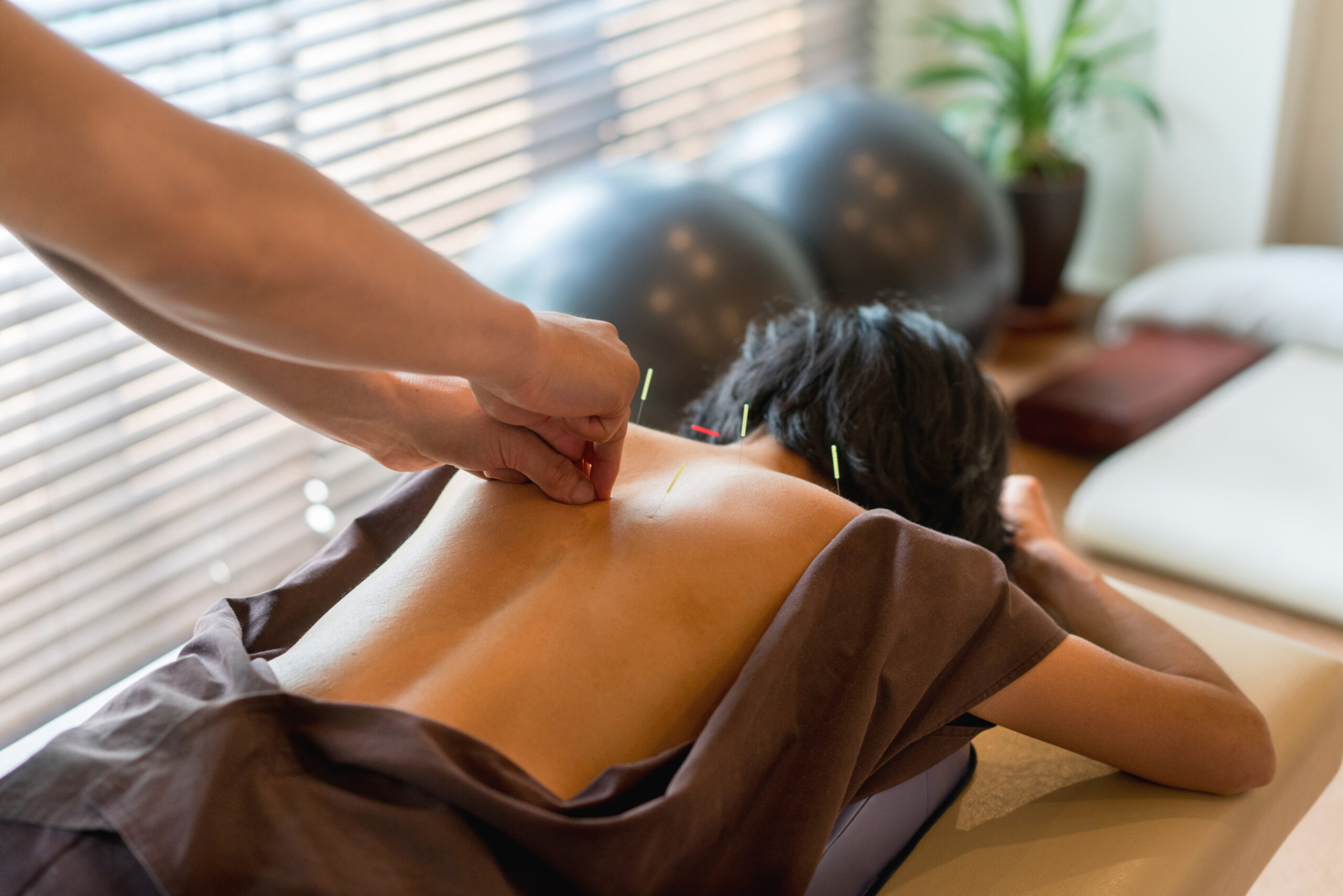 acupuncture doctors